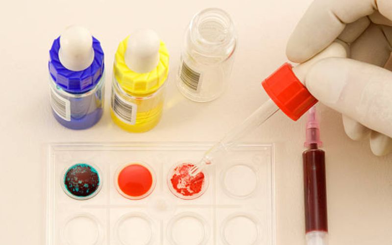 Xác đinh nhóm máu dựa trên sự hiện diện của kháng nguyên bề mặt