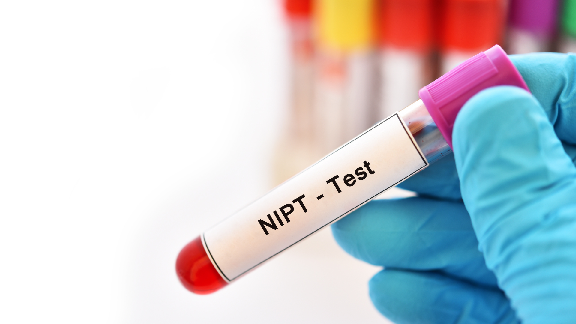 Giải đáp xét nghiệm nipt 9 tuần có biết trai hay gái không?