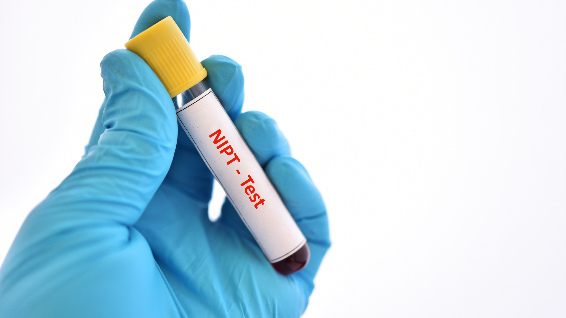 Cơ chế giúp xét nghiệm NIPT nhận biết giới tính