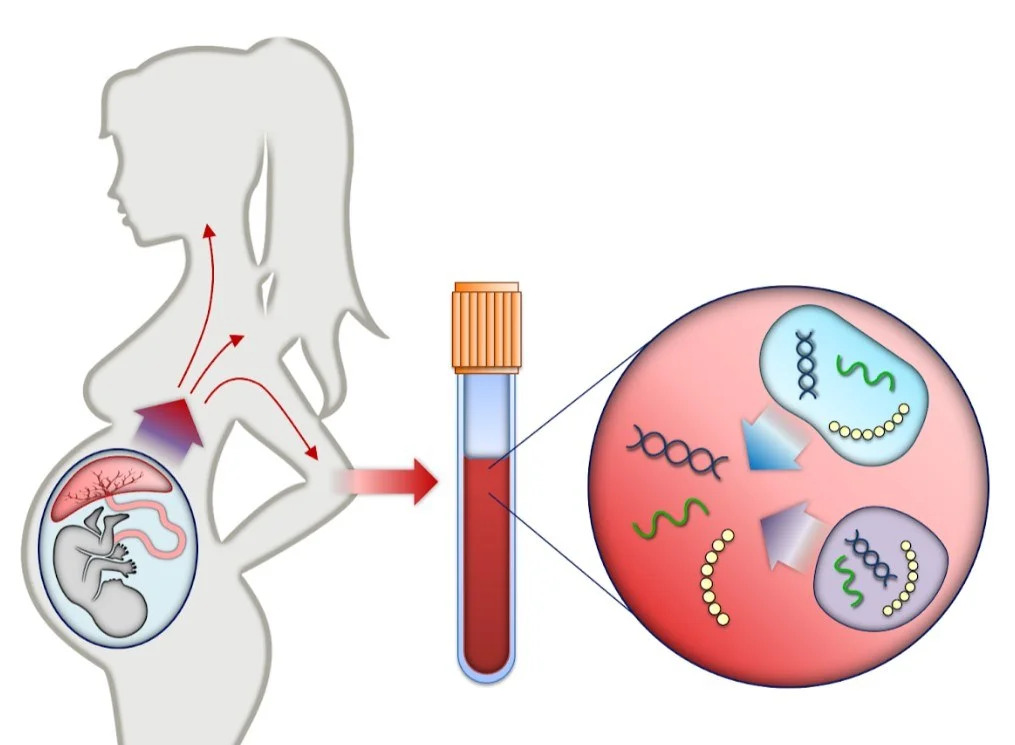 Xét nghiệm NIPT giúp sàng lọc các bệnh liên quan đến bất thường nhiễm sắc thể