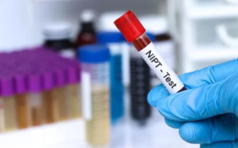 Xét nghiệm NIPT nên được thực hiện từ tuần thứ 10 trở đi để đem lại kết quả chính xác nhất