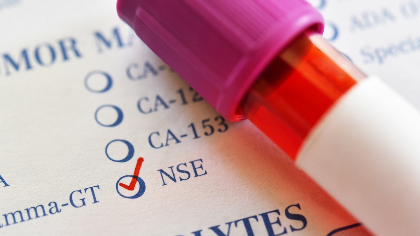 NSE (Neuron Specific Enolase) là một enzyme đặc hiệu của tế bào thần kinh và tế bào nội tiết thần kinh