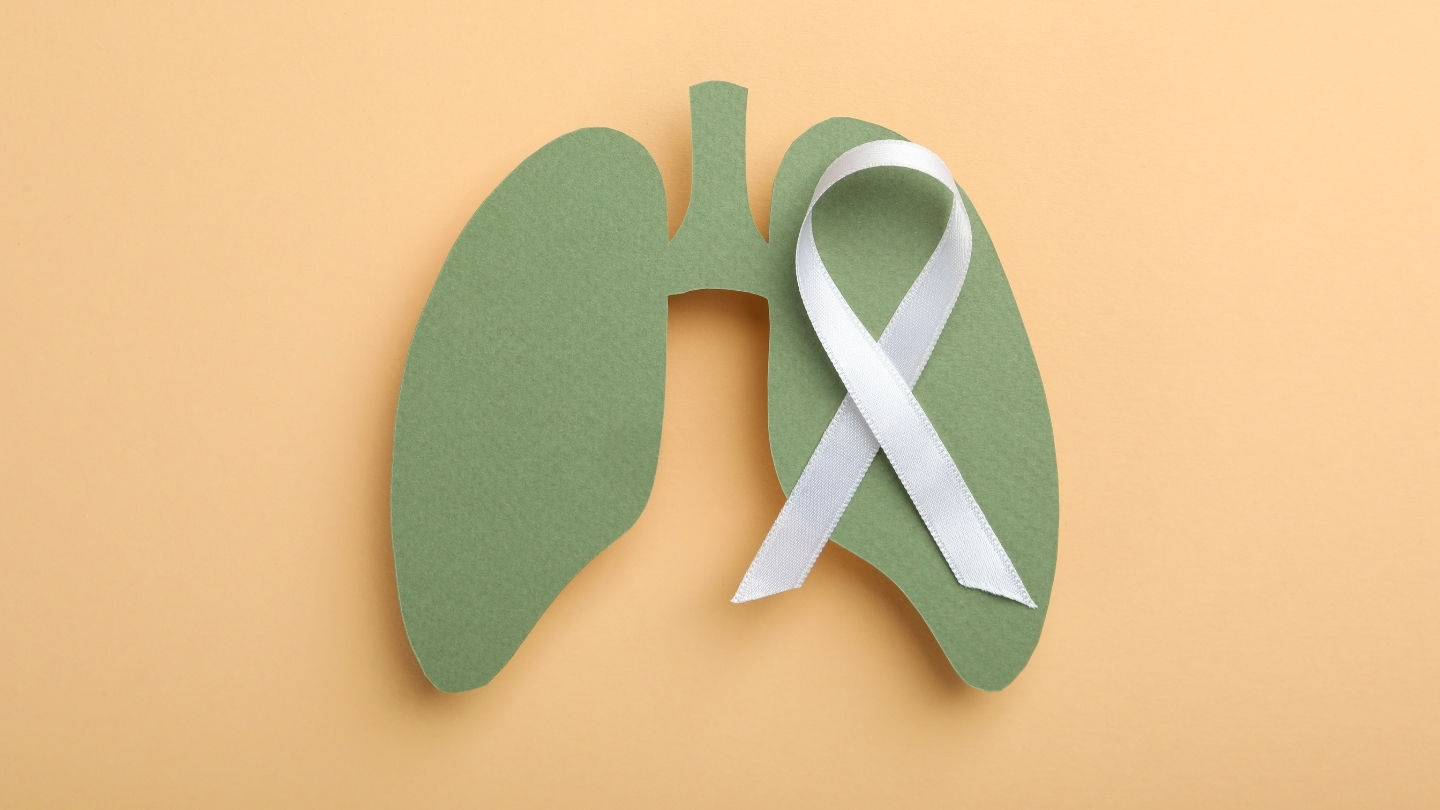 Chỉ số NSE vượt quá ngưỡng bình thường có thể phản ánh sự hiện diện của ung thư phổi tế bào nhỏ