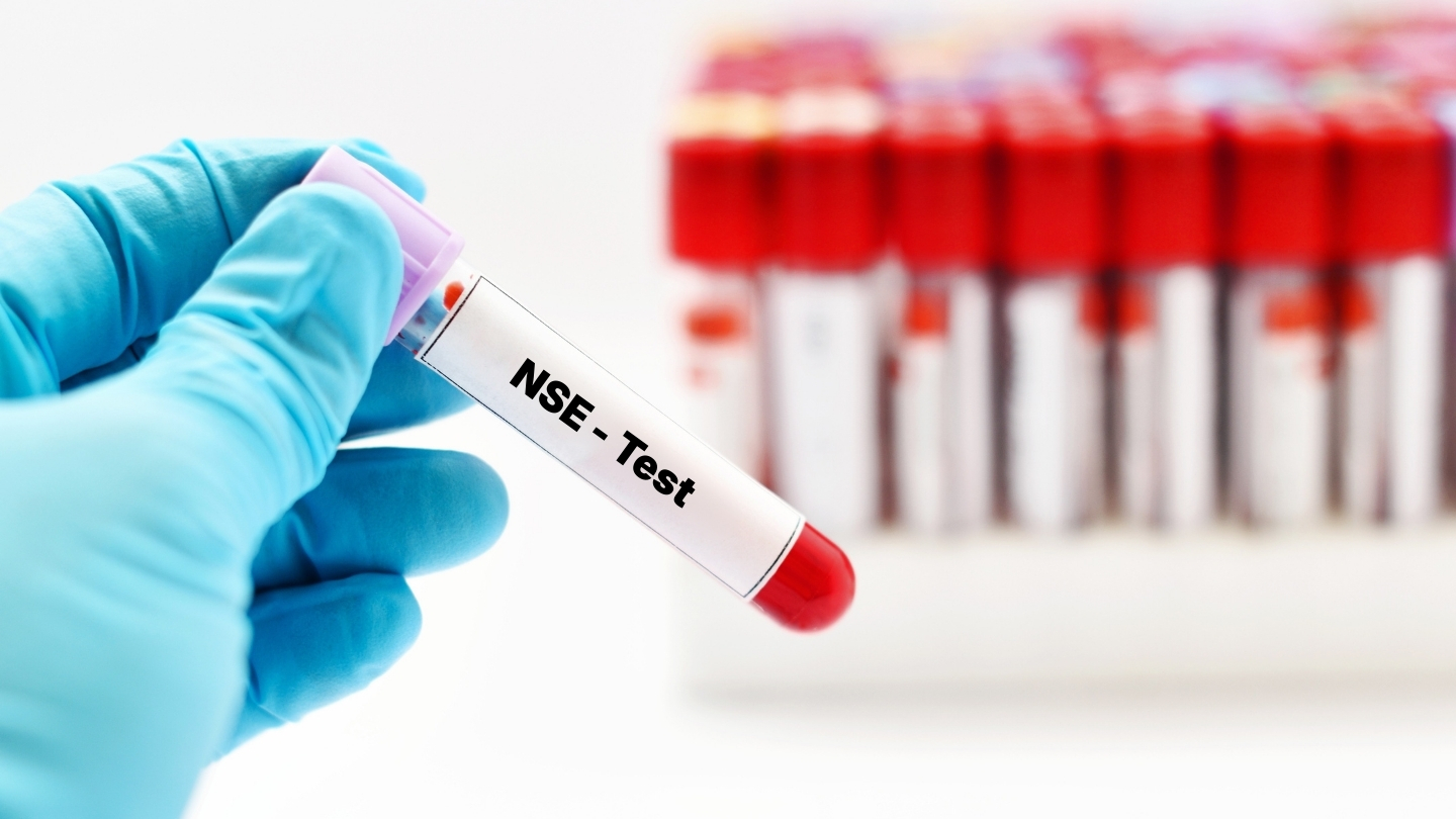Giá trị bình thường của NSE thường nằm trong khoảng từ 0 đến 12,5 ng/mL hoặc đôi khi dưới 16 ng/mL