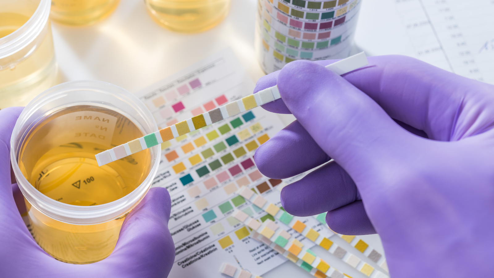 Lưu ý đây là bước sàng lọc ban đầu