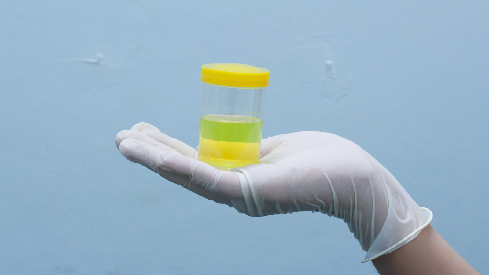 Lấy nước tiểu giữa dòng