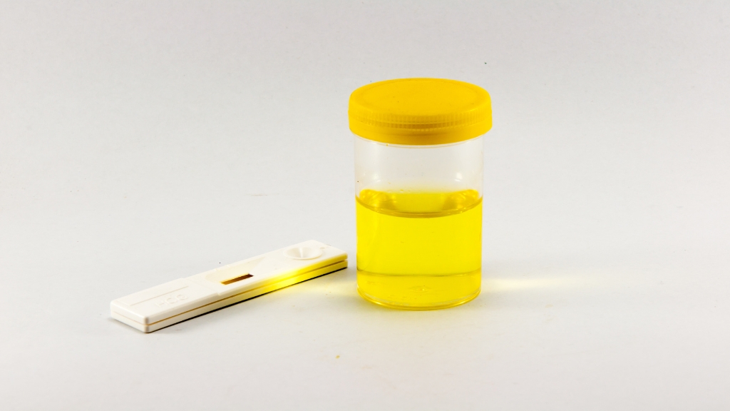 Giải đáp thắc mắc xét nghiệm nước tiểu có biết mang thai không