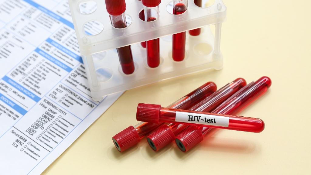 Người có nguy cơ phơi nhiễm HIV nên xét nghiệm sau 2 - 3 tháng để có kết quả chính xác