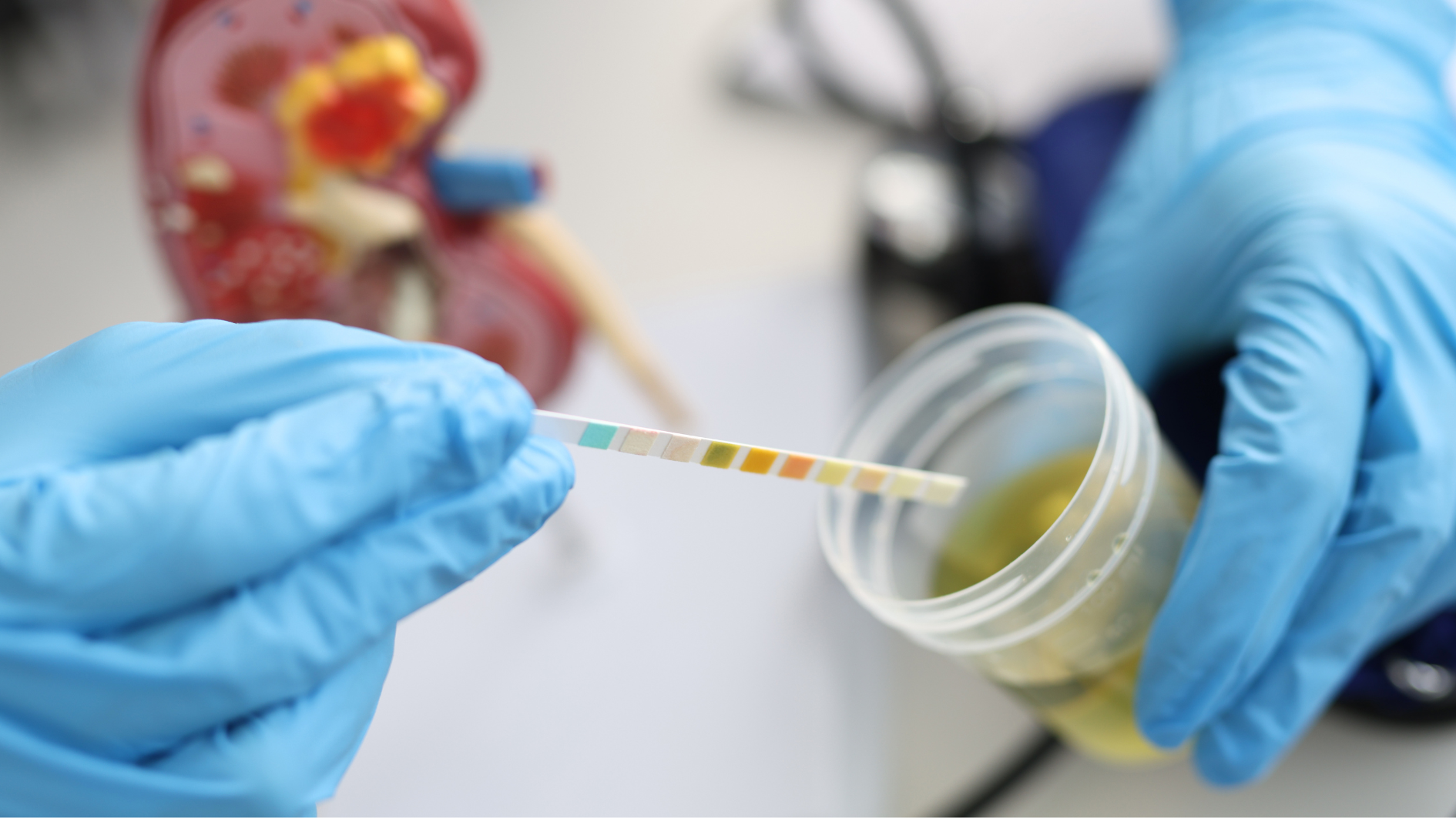 Xét nghiệm nước tiểu khi mang thai là gì? Có ý nghĩa gì? 1