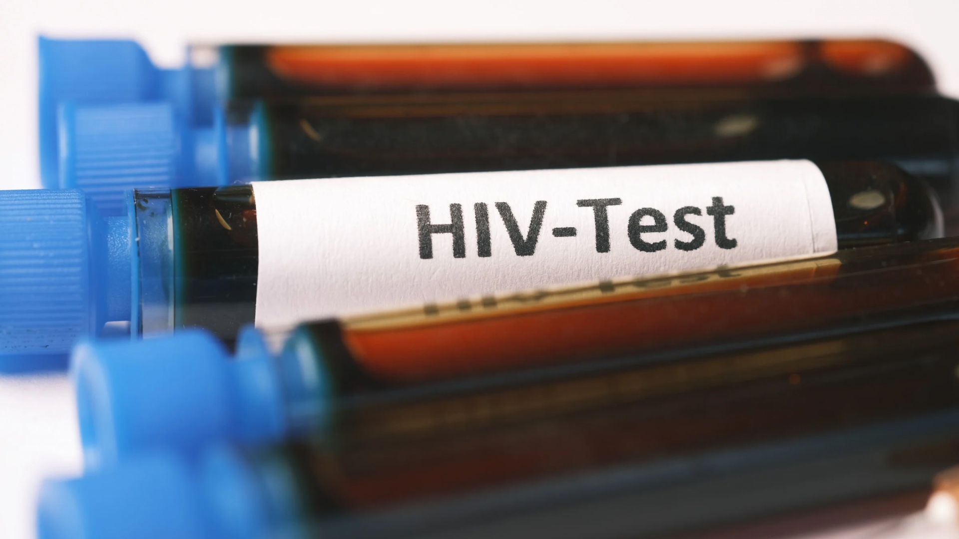 Xét nghiệm PCR HIV là gì? Ưu và nhược điểm của xét nghiệm PCR chẩn đoán HIV 2