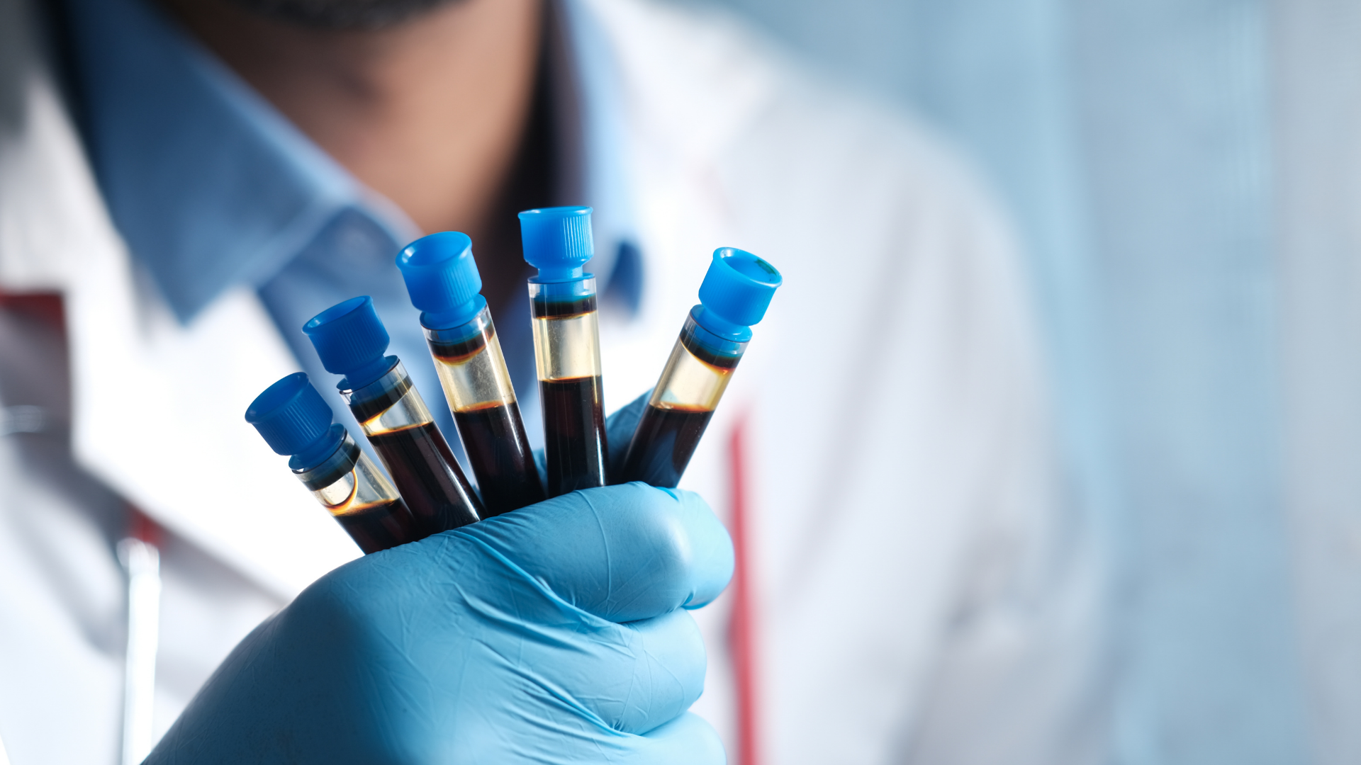 Xét nghiệm progesterone: Hiểu đúng để đánh giá khả năng sinh sản và sức khỏe nội tiết tố nữ 4