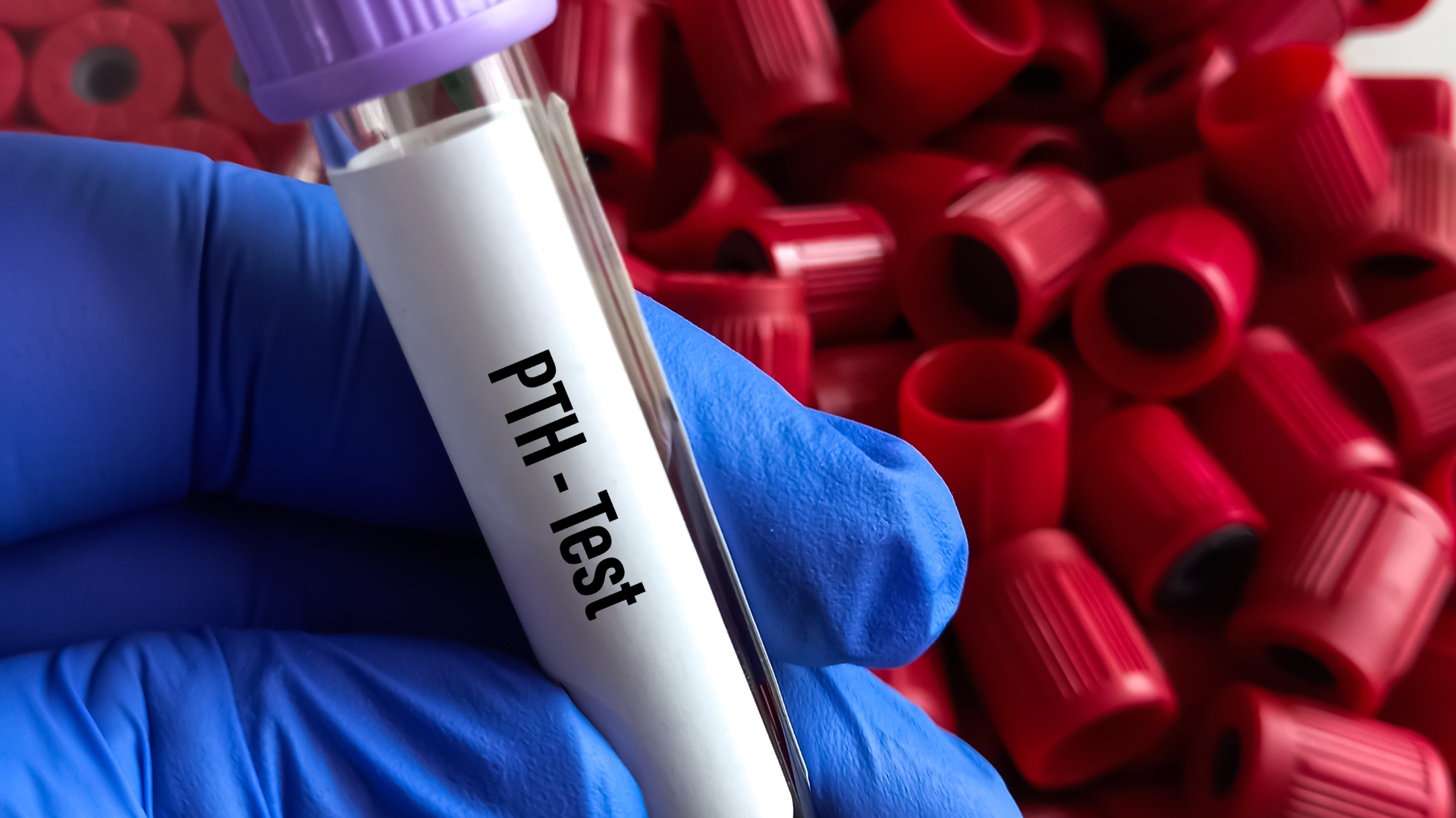 Kết quả xét nghiệm hỗ trợ phản ánh mức độ hoạt động của tuyến cận giáp và khả năng điều hòa canxi