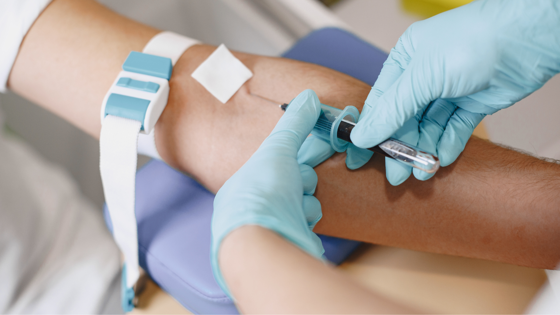 Tuân thủ hướng dẫn nhân viên y tế trong quá trình xét nghiệm RPR