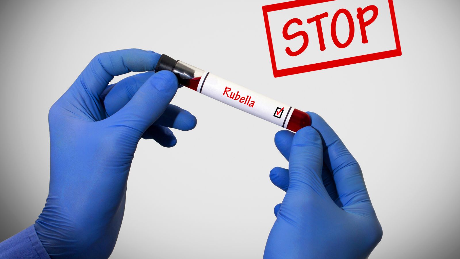 xet-nghiem-rubella-de-lam-gi-cac-buoc-xet-nghiem-nhu-the-nao-3