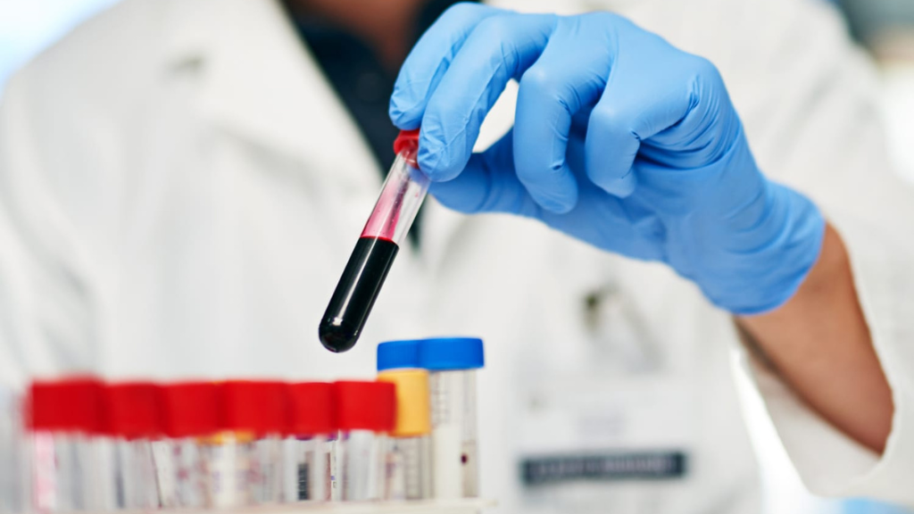 xet-nghiem-soi-tai-nha-va-cach-phong-ngua-hieu-qua 4.png