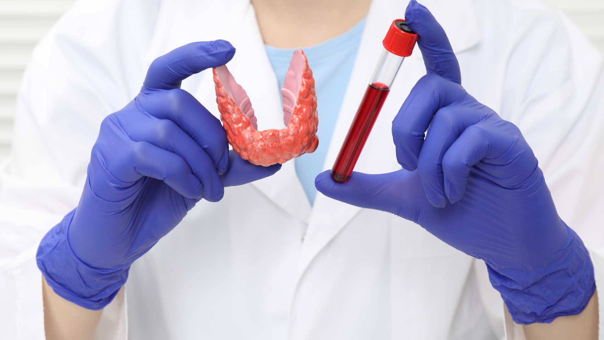 Xét nghiệm suy giáp giúp phát hiện sớm rối loạn hormone tuyến giáp thông qua các chỉ số máu quan trọng