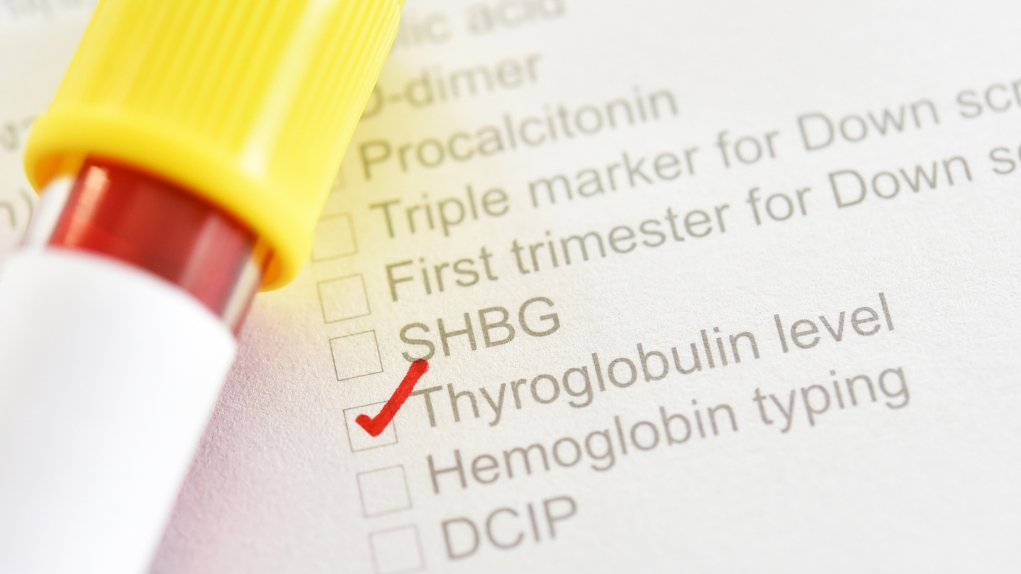 Ở người bình thường, nồng độ TG dao động từ 0,2 đến 50 ng/mL