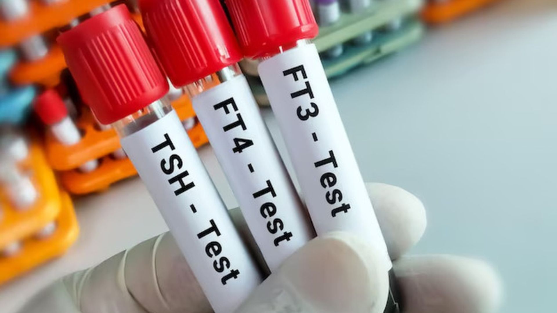 Xét nghiệm chức năng tuyến giáp cũng là một trong các xét nghiệm tiền mãn kinh