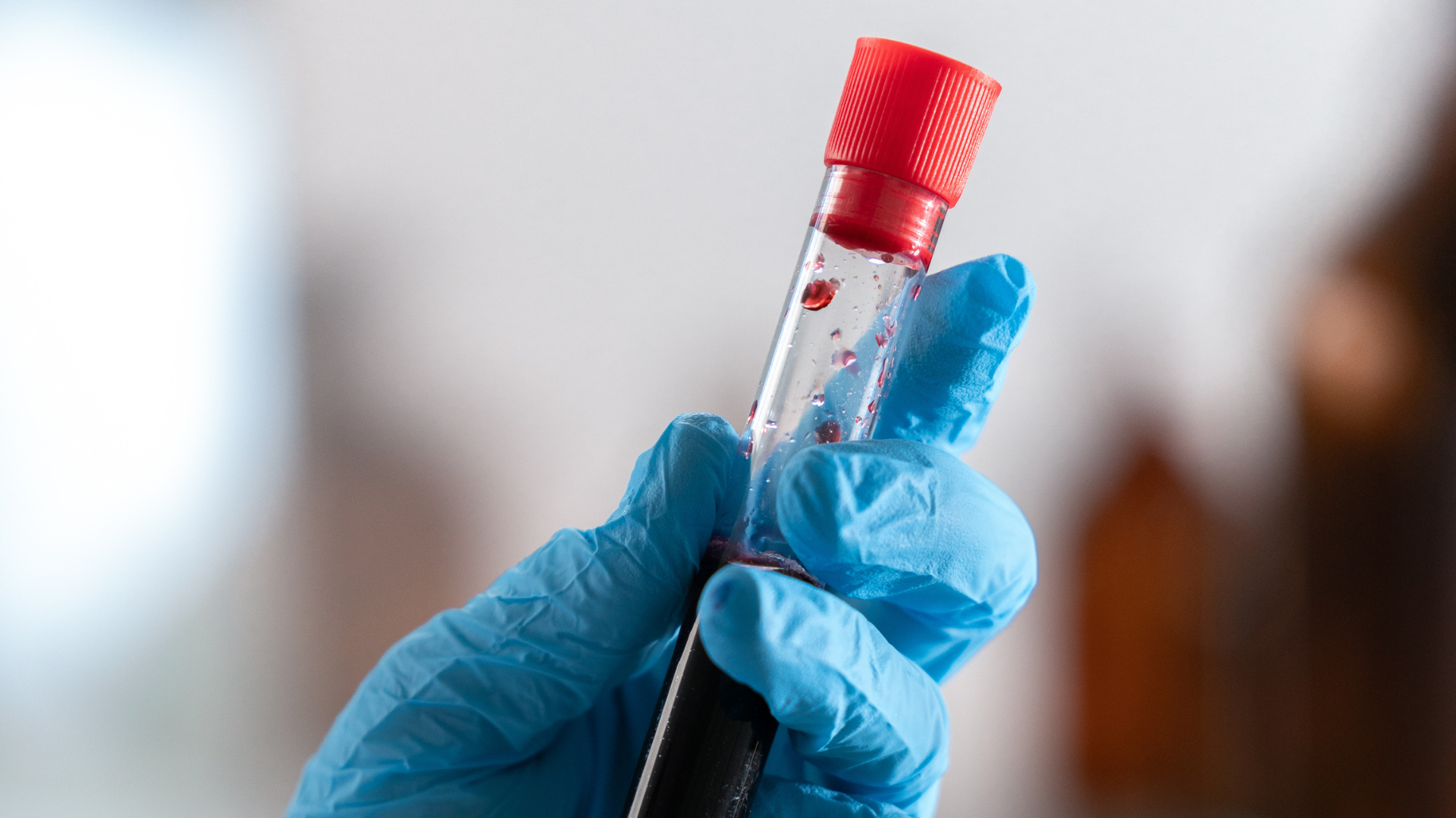 Xét nghiệm máu kiểm tra chức năng gan, thận và tiểu cầu thường dao động từ 200.000 đến 800.000 VNĐ