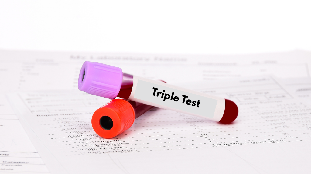Xét nghiệm triple test hết bao nhiêu tiền? Mức chi phí thực tế hiện nay
