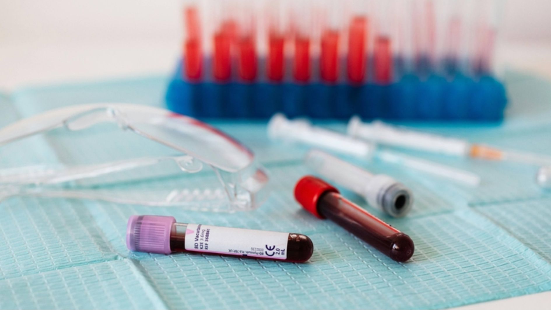 Chỉ số TSH nằm trong khoảng tham chiếu&nbsp;0,4 - 4,0 mIU/L