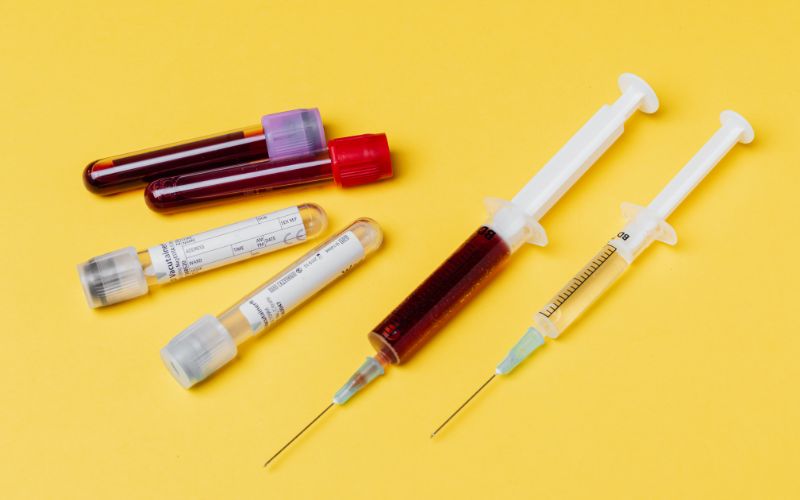 xet-nghiem-tuyen-giap-bao-nhieu-tien-3