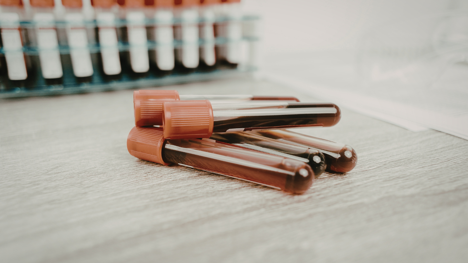 Xét nghiệm máu à bước đánh giá ban đầu của ung thư máu ở trẻ em