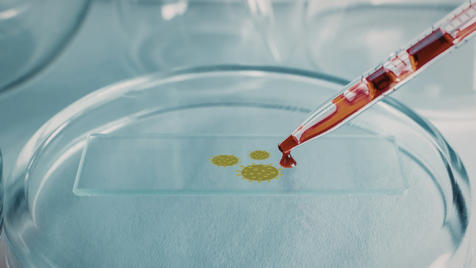 Xét nghiệm vi sinh giúp bác sĩ có thể xác định chính xác tác nhân gây bệnh