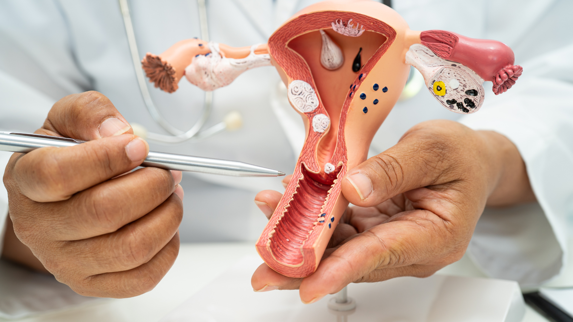 Bất thường ở tử cung hoặc cổ tử cung có thể khiến thai khó làm tổ, phát triển không ổn định