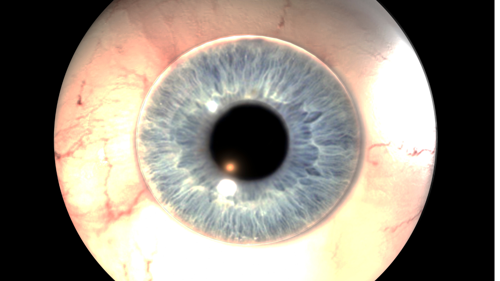 Siêu âm B-scan là phương pháp giúp chẩn đoán xuất huyết dịch kính khi mắt bị mờ nặng