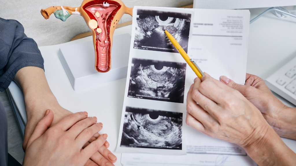 Xuất huyết nang buồng trứng: Nguyên nhân, dấu hiệu và cách điều trị an toàn 3