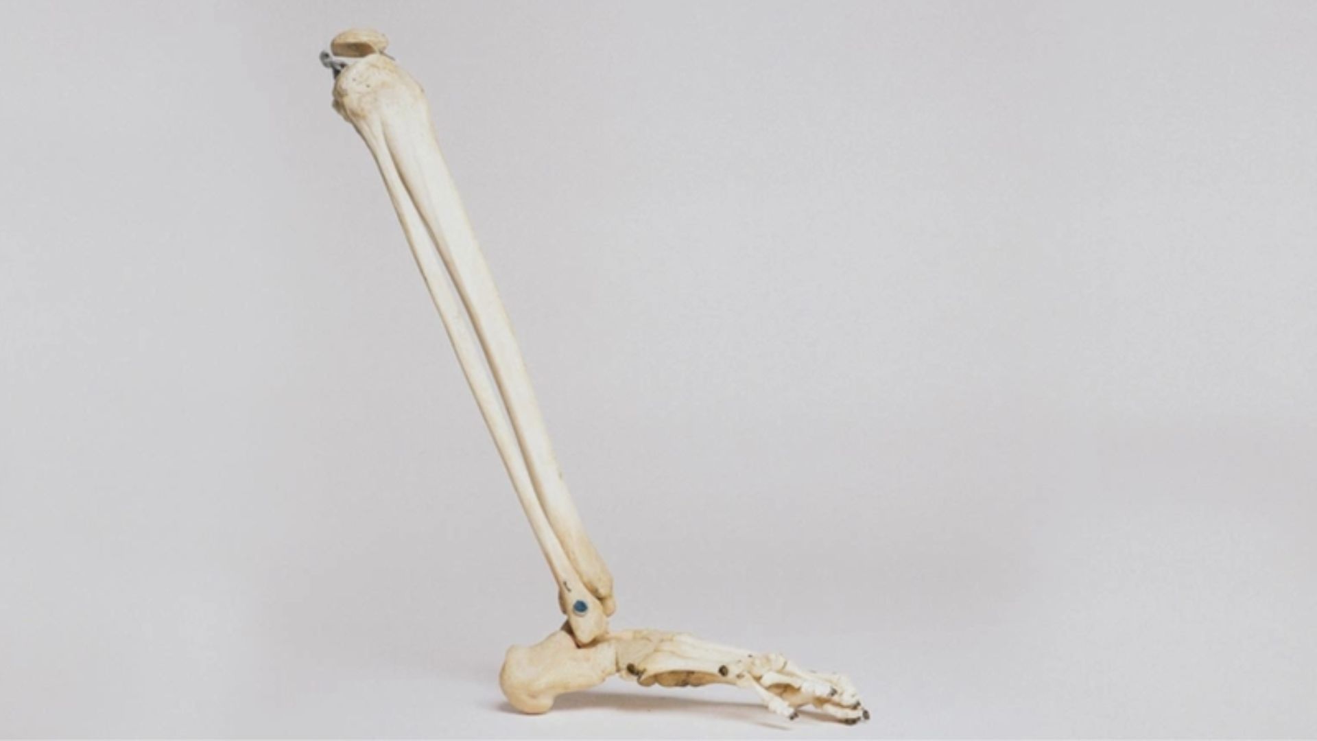 Xương mác là một trong hai loại xương cẳng chân